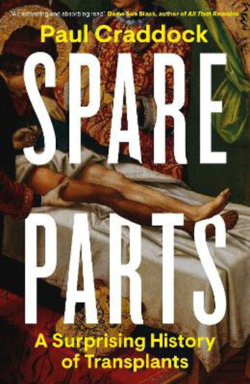 Picture of Spare Parts: A Surprising History of Transplants